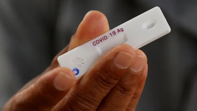 கொரோனா வைரஸ்