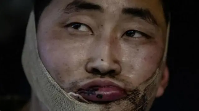 ज्यानुअरीको सुरुमा युक्रेनले दुई घाइते उत्तर कोरियाली सैनिकहरूलाई कब्जा गरेको जनाएको थियो
