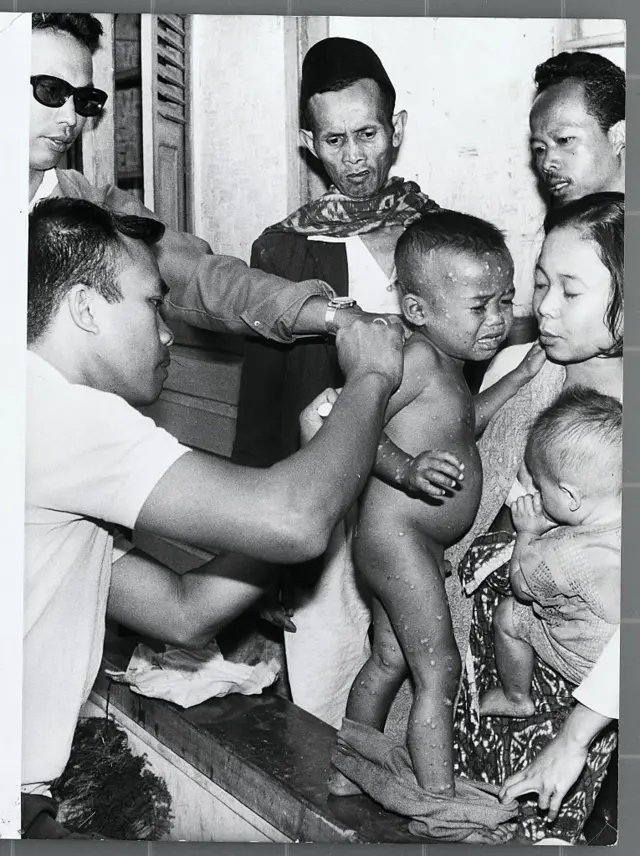 Seorang anak di Indonesia menerima vaksin cacar pada era pelaksanaan Global Smallpox Eradication Program pada periode 1967 sampai 1974.