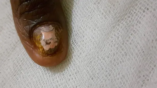 Shamarreen BBC'n dubbise waggoota kudha shan darbaniif fangasiin qeensa ishee hube miidhagina ishee balleesse