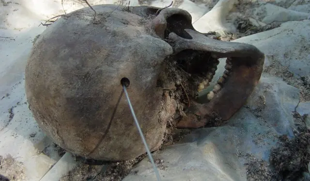 Череп с пулевым отверстием