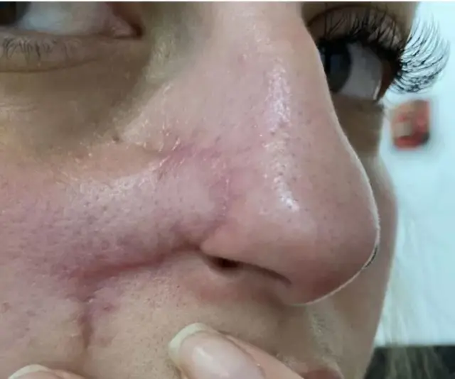 பெண்கள், ஆரோக்கியம்