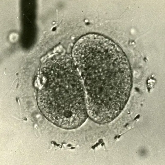 İnsan yumurtası ilk defa 1944 yılında başarılı olarak döllendi.