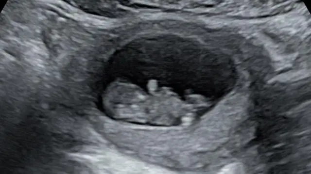 ሪሃነን ሎውሰን እርግዝና