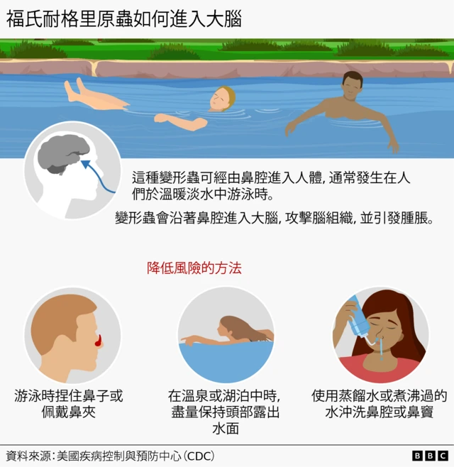 視覺新聞圖表展示福氏耐格里原蟲如何進入大腦。