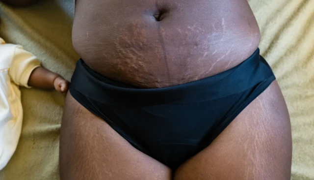 உடல் எடை குறைப்பு