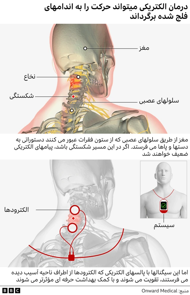 گرافیکی که نحوه عملکرد درمان را نشان میدهد