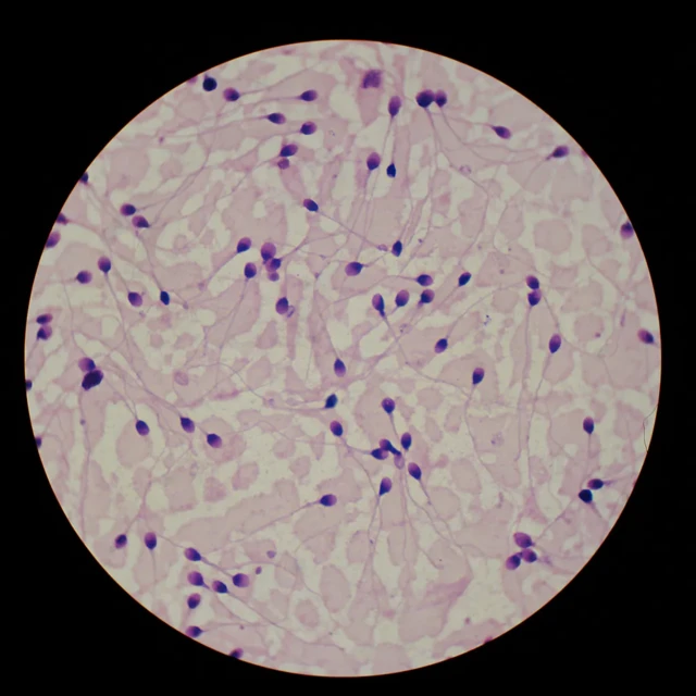 Intanga z'abagabo ni nto cane ku buro bishobora kugorana kuzikorako ubushakashatsi. Izitoranijwe zirashirwamwo ibara kugirango zibashe kuboneka muri rugagamisha (microscope)