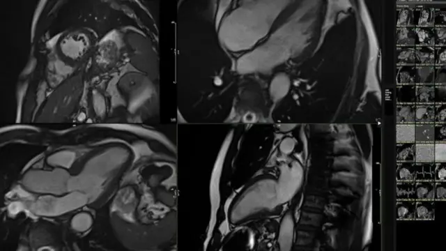 Imagensbet365 entrar cassinoexames do coração