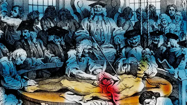 Caricatura de autopsia en el siglo XIX