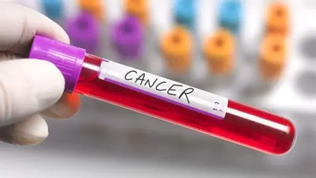 ਕੈਂਸਰ ਦੀ ਜਾਂਚ