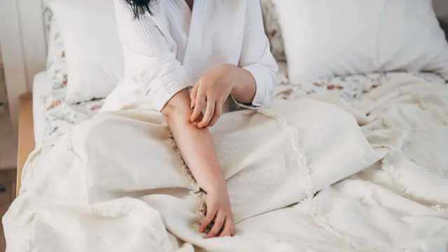 एक्ज़िमा 