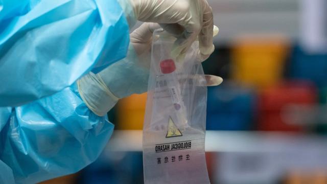 香港某新冠病毒全民检测采样中心内一名技术人员把样本封装送检（1/9/2020）