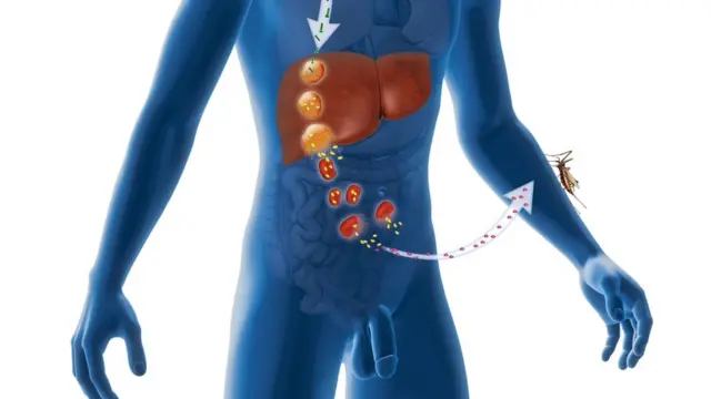 illsutration of malaria in liver