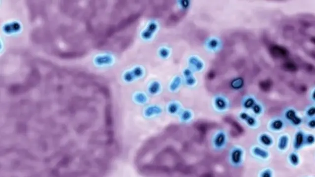 دراسة مختبرية