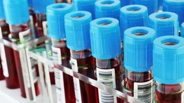 রক্তের টিউব