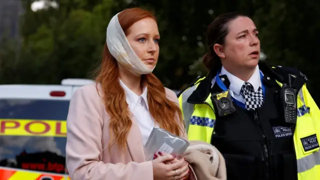 یکی از مسافرانی که صورتش آتش گرفته و سرپایی درمان شده است