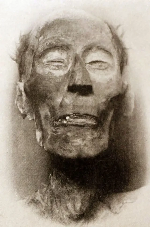 چهره مومیایی رامسس دوم، با بقایای مویی که هنوز بر سر او دیده می‌شود