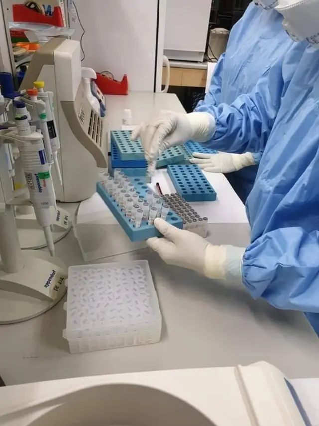 ปัจจุบันมีห้องปฏิบัติการตรวจโควิด-19 ที่ผ่านการประเมินของกรมวิทยาศาสตร์การแพทย์แล้ว 57 แห่ง อยู่ระหว่างการประเมินและกำลังจัดตั้งอีก 40 แห่ง