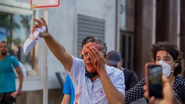 Um homem foi ferido no olho esquerdo durante protestofbetRecife