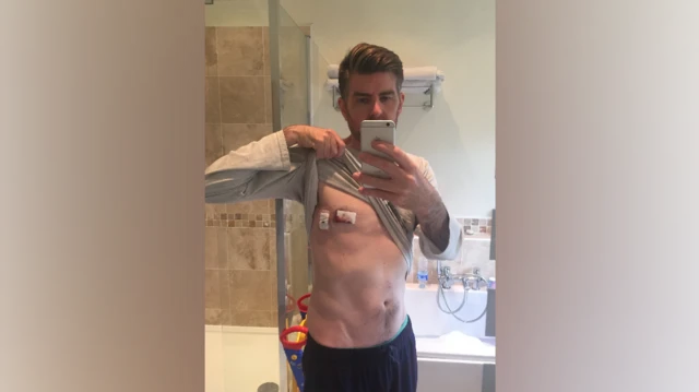 Philip Anderson xəstəliyi erkən aşkar etdiyi üçün şanslı olduğuna inanır.