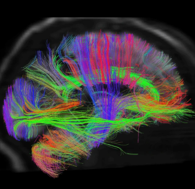 Um exame cerebral
