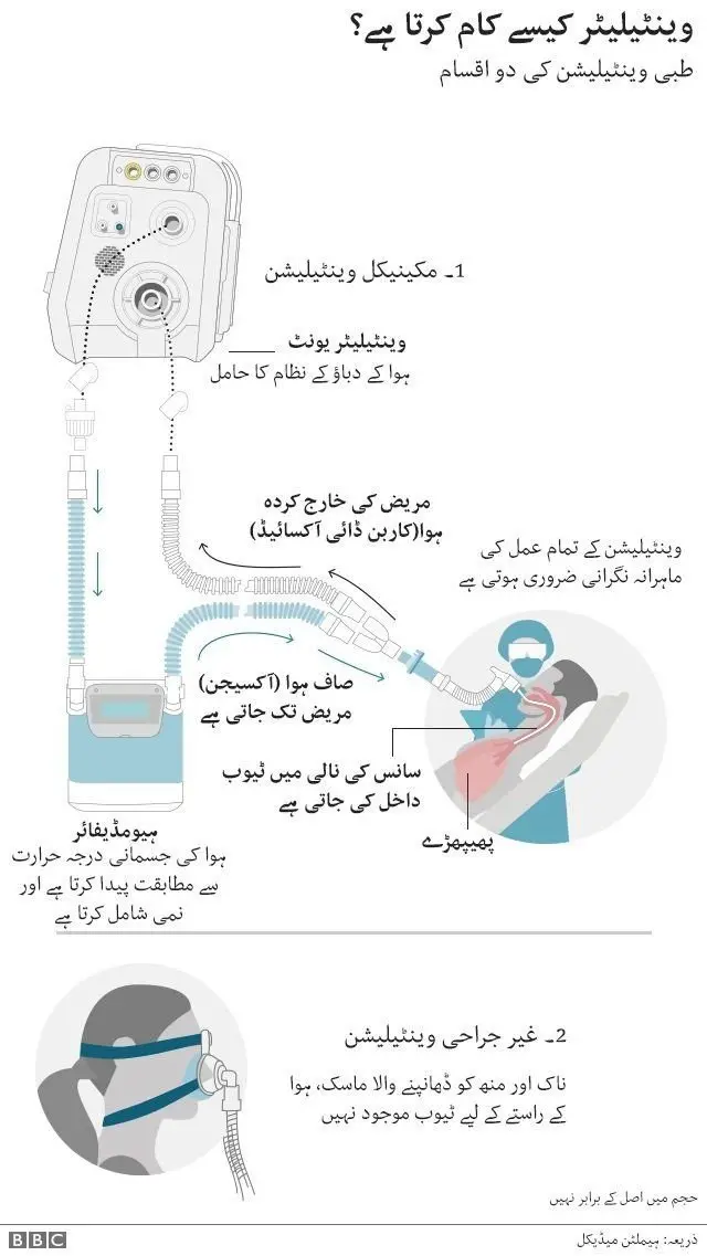 وینٹیلیٹرز