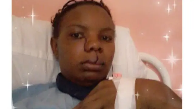 Teresia Njeri alipofanyiwa upasuaji