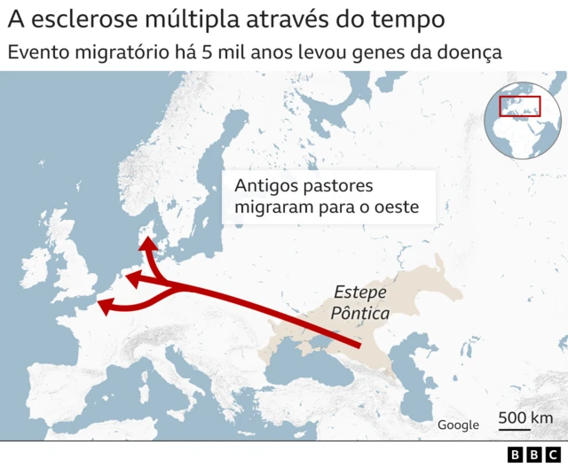 Mapa mostra as origens da esclerose múltipla