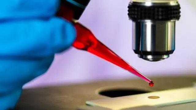 VVU huingia kwenye seli nyeupe za damu kupitia protini iitwayo CCR5.