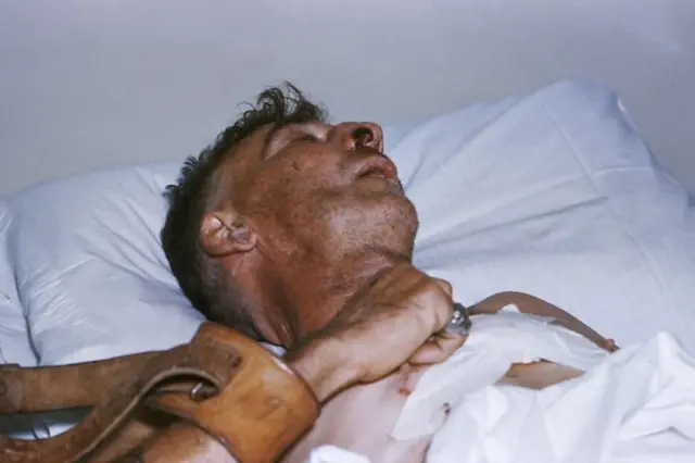 रेबिज भाइरस मस्तिष्कमा र तन्तुहरूमा फैलिन्छ। रेबिज भाइरसले सङ्क्रमण गरेपछि ज्वरो र अत्यधिक थुक आउने अनि घाँटी काँप्ने हुन्छ। त्यसबाहेक मानिसहरूको व्यहारमा पनि परिवर्तन आउँछ। त्यसपछि पानी देख्दा डर लाग्ने र पक्षाघात हु्न्छ।