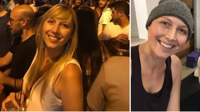 Montagem com duas fotossite de aposta esportiva que da bonusKirsty Hopgood, uma com cabelo longo; e outra sem cabelo, cobertasite de aposta esportiva que da bonusgorro