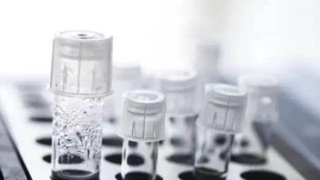 IVF પદ્ધતિમાં સ્ત્રીનાં અંડબીજ તથા પુરુષનાં શુક્રાણુઓનું કસનળીમાં મિલન કરાવવામાં આવે છે.