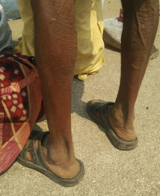 రైతుల నిరసన