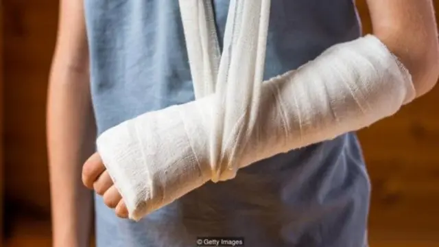 પ્લાસ્ટર ધરાવતી યુવતી