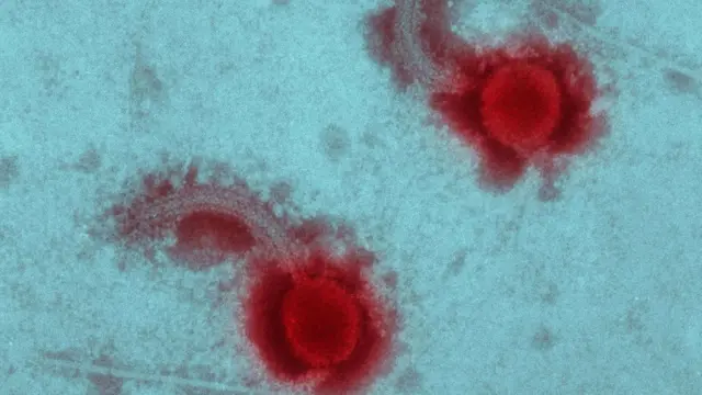 बैक्टीरिया