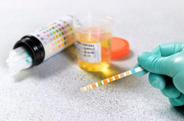 சிறுநீர் நிறம்