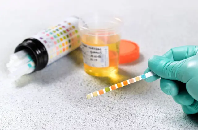 சிறுநீர் நிறம்