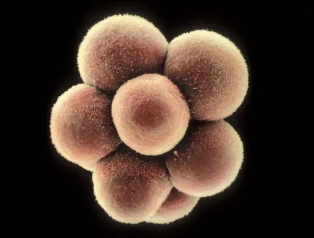 Deoba ćelija - mikroskopski prikaz