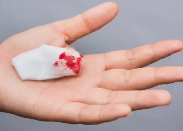 Compresse tachée de sang