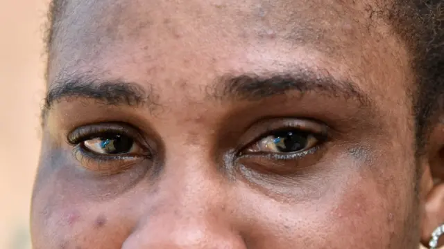 Las manchas son una de las consecuencias más frecuentes del mal uso de estos productos.