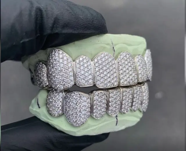 வைரப் பல்செட்