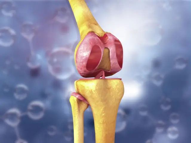 संधिवात म्हणजे काय? तो टाळण्यासाठी तरुण वयातच काय काळजी घ्यावी? वाचा