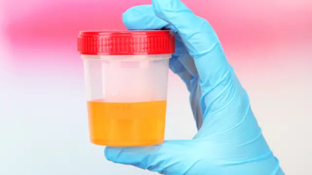 Muestra de orina