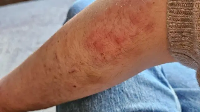 क्लेअर मिलर म्हणतात की त्यांच्यावर आधारित बीबीसीची फिल्म प्रसारित झाल्यापासून त्यांचं आयुष्य आणखीच वाईट झालं आहे.
