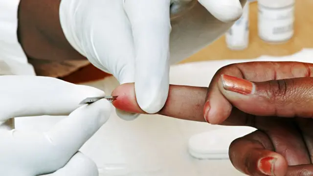 La première condition pour y avoir accès est la présentation d'un test de dépistage du VIH qui est négatif.