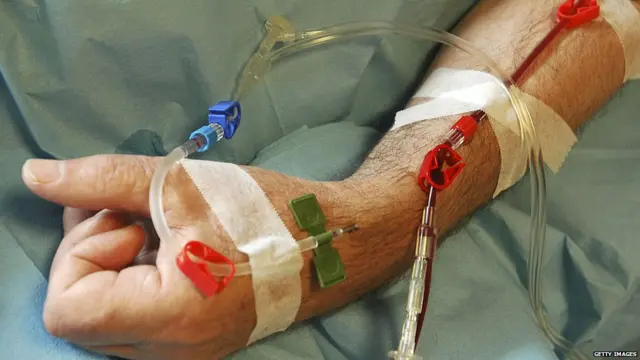 प्रातिनिधिक फोटो