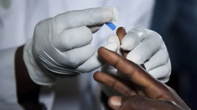 An samu raguwar masu kamuwa da cutar HIV a Najeriya