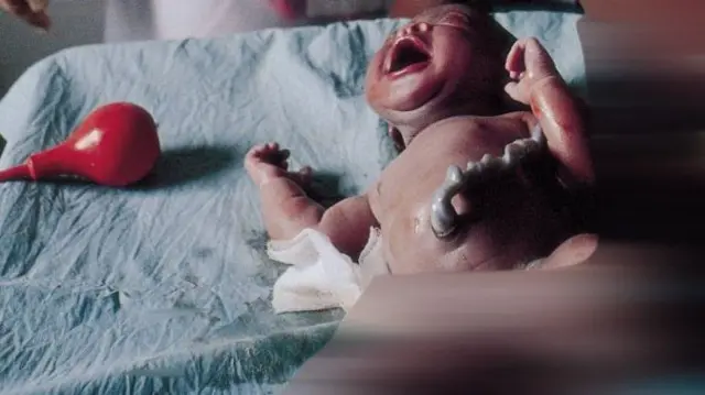 Nwata a mụrụ ọhụrụ na alọ ya