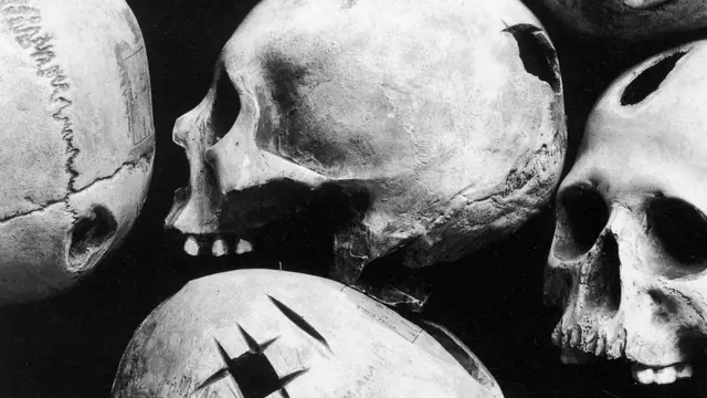 جماجم مثقوبة عثر عليها في بيرو